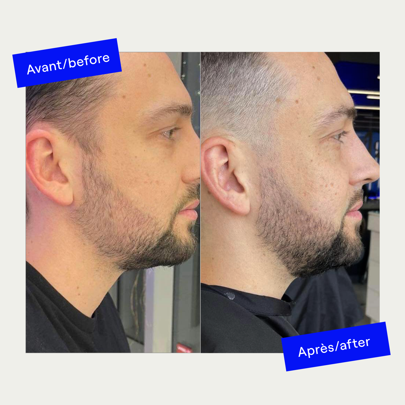 beard-growth-kit-menz-club-beard-care-menz-club